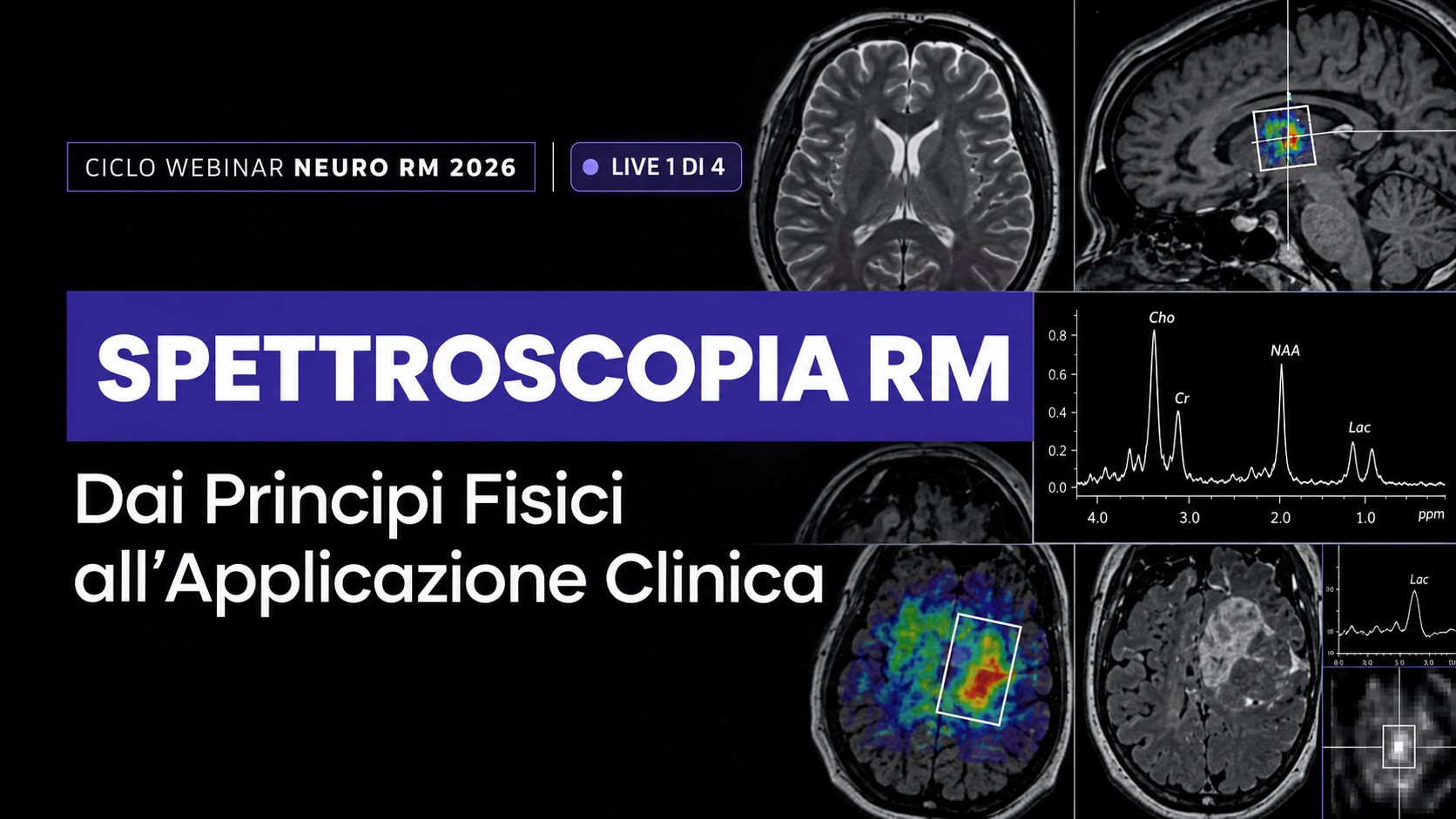 Spettroscopia RM: Dai Principi Fisici all'Applicazione Clinica